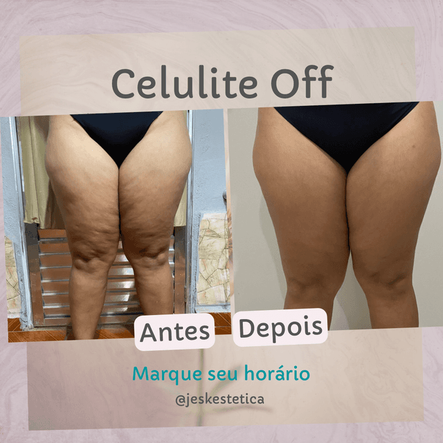 Celulite Off