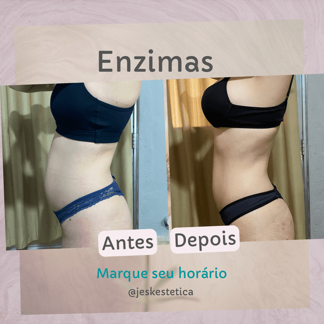 Enzimas