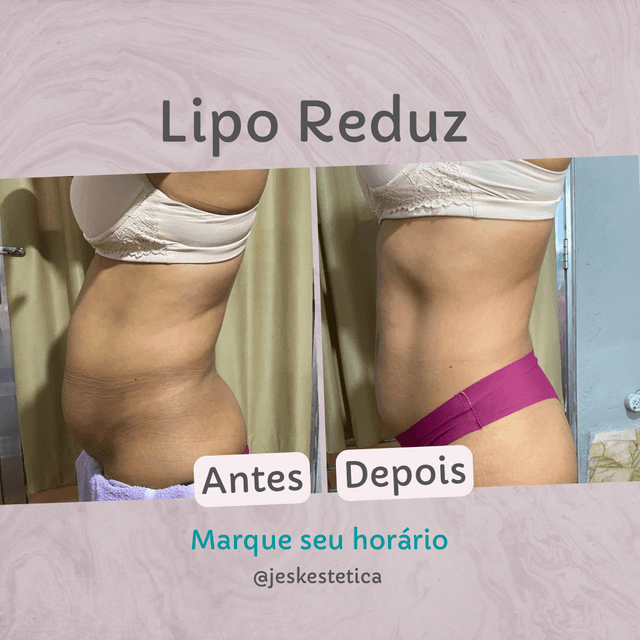 Lipo Reduz